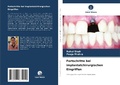 Cover: Fortschritte bei implantatchirurgischen Eingriffen - Verlag Unser Wissen