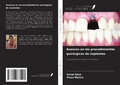 Cover: Avances en los procedimientos quir&uacute;rgicos de implantes - Ediciones Nuestro Conocimiento