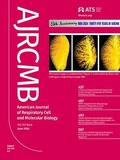 Cover: American Journal of Respiratory Cell and Molecular Biology (AJRCMB) - American Thoracic Society