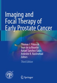 Enlarge image Cover: Imaging and Focal Therapy of Early Prostate Cancer - Springer