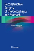 Bild: Reconstructive Surgery of the Oesophagus and Stomach - Springer