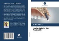 Abbildung von: Implantate in der Prothetik - Verlag Unser Wissen