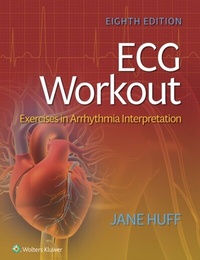 Abbildung von: ECG Workout - Wolters Kluwer Health