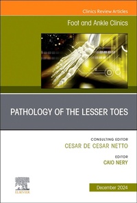 Abbildung von: Pathology of the Lesser Toes, An issue of Foot and Ankle Clinics of North America: Volume 29-4 - Churchill Livingstone
