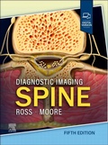 Cover: Diagnostic Imaging: Spine - Churchill Livingstone