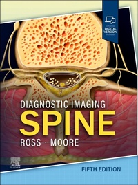 Abbildung von: Diagnostic Imaging: Spine - Churchill Livingstone