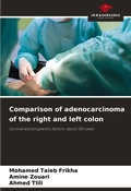 Cover: Comparison of adenocarcinoma of the right and left colon - Our Knowledge Publishing