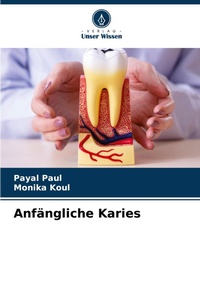 Enlarge image Cover: Anfaengliche Karies - Verlag Unser Wissen