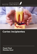 Cover: Caries incipientes - Ediciones Nuestro Conocimiento