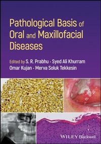 Bild vergrößern Bild: Pathological Basis of Oral and Maxillofacial Diseases - Wiley