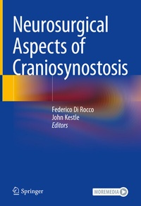 Abbildung von: Neurosurgical Aspects of Craniosynostosis - Springer