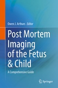 Bild: Post Mortem Imaging of the Fetus & Child - Springer