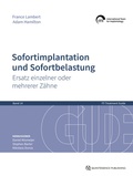 Cover: Sofortimplantation und Sofortbelastung - Quintessenz Verlag