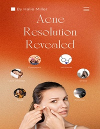 Abbildung von: Acne Resolution Revealed - Lulu.com