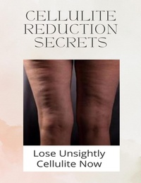 Abbildung von: Cellulite Reduction Secrets - Lulu.com