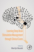 Abbildung von: Learning Deep Brain Stimulation Management through Clinical Cases - Academic Press