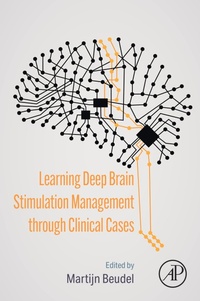 Abbildung von: Learning Deep Brain Stimulation Management through Clinical Cases - Academic Press