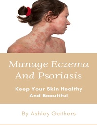 Abbildung von: Manage Eczema And Psoriasis - Lulu.com