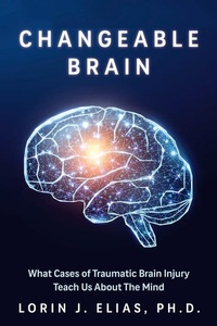 Abbildung von: Broken Brains - Dundurn Press