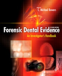 Abbildung von: Forensic Dental Evidence - Academic Press