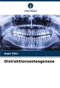 Cover: Distraktionsosteogenese - Verlag Unser Wissen
