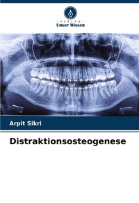 Enlarge image Cover: Distraktionsosteogenese - Verlag Unser Wissen