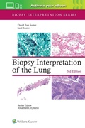 Cover: Biopsy Interpretation of the Lung - WOLTERS KLUWER HEALTH