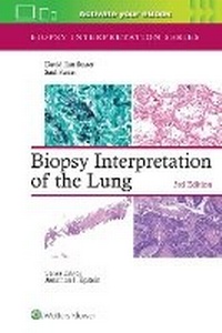Abbildung von: Biopsy Interpretation of the Lung - WOLTERS KLUWER HEALTH