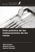 Cover: Gu&iacute;a pr&aacute;ctica de las restauraciones de las ra&iacute;ces - Ediciones Nuestro Conocimiento