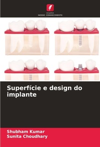 Enlarge image Cover: Superficie e design do implante - Edicoes Nosso Conhecimento