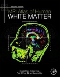 Abbildung von: MRI Atlas of Human White Matter - Academic Press