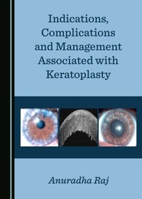 Abbildung von: Indications, Complications and Management Associated with Keratoplasty - Cambridge Scholars Publishing