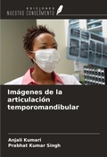 Cover: Im&aacute;genes de la articulaci&oacute;n temporomandibular - Ediciones Nuestro Conocimiento