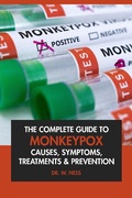 Cover: The Complete Guide to Monkeypox: Causes, Symptoms, Treatment & Prevention. - Interactive Media Licensing