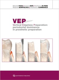 Abbildung von: VEP Vertical Edgeless Preparation - Quintessenza Edizioni S.r.l.