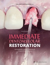 Abbildung von: Immediate Dentoalveolar Restoration - Quintessence Publishing Co, Inc