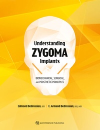 Abbildung von: Understanding Zygoma Implants - Quintessence Publishing (IL)