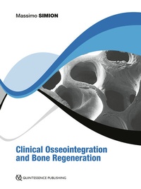 Abbildung von: Clinical Osseointegration and Bone Regeneration - Quintessence Publishing Co. Ltd.