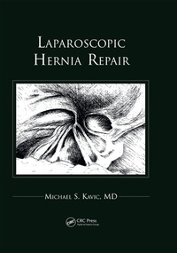 Abbildung von: Laparoscopic Hernia Repair - Routledge