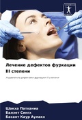 Cover: Lechenie defektow furkacii III stepeni - Sciencia Scripts