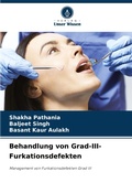 Cover: Behandlung von Grad-III-Furkationsdefekten - Verlag Unser Wissen