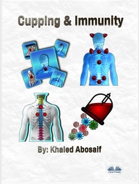 Bild vergrößern Bild: Cupping & Immunity - Tektime