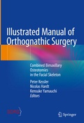 Cover: Illustrated Manual of Orthognathic Surgery - Springer