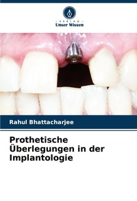 Abbildung von: Prothetische UEberlegungen in der Implantologie - Verlag Unser Wissen
