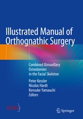 Cover: Illustrated Manual of Orthognathic Surgery - Springer