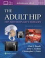 Cover: The Adult Hip: Hip Arthroplasty Surgery Print + eBook with Multimedia - WOLTERS KLUWER HEALTH