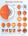 Cover: Disorders of the Eye Anatomical Chart - WOLTERS KLUWER HEALTH