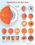 Cover: Disorders of the Eye Anatomical Chart - WOLTERS KLUWER HEALTH