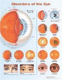 Enlarge image Cover: Disorders of the Eye Anatomical Chart - WOLTERS KLUWER HEALTH