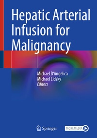 Abbildung von: Hepatic Arterial Infusion for Malignancy - Springer